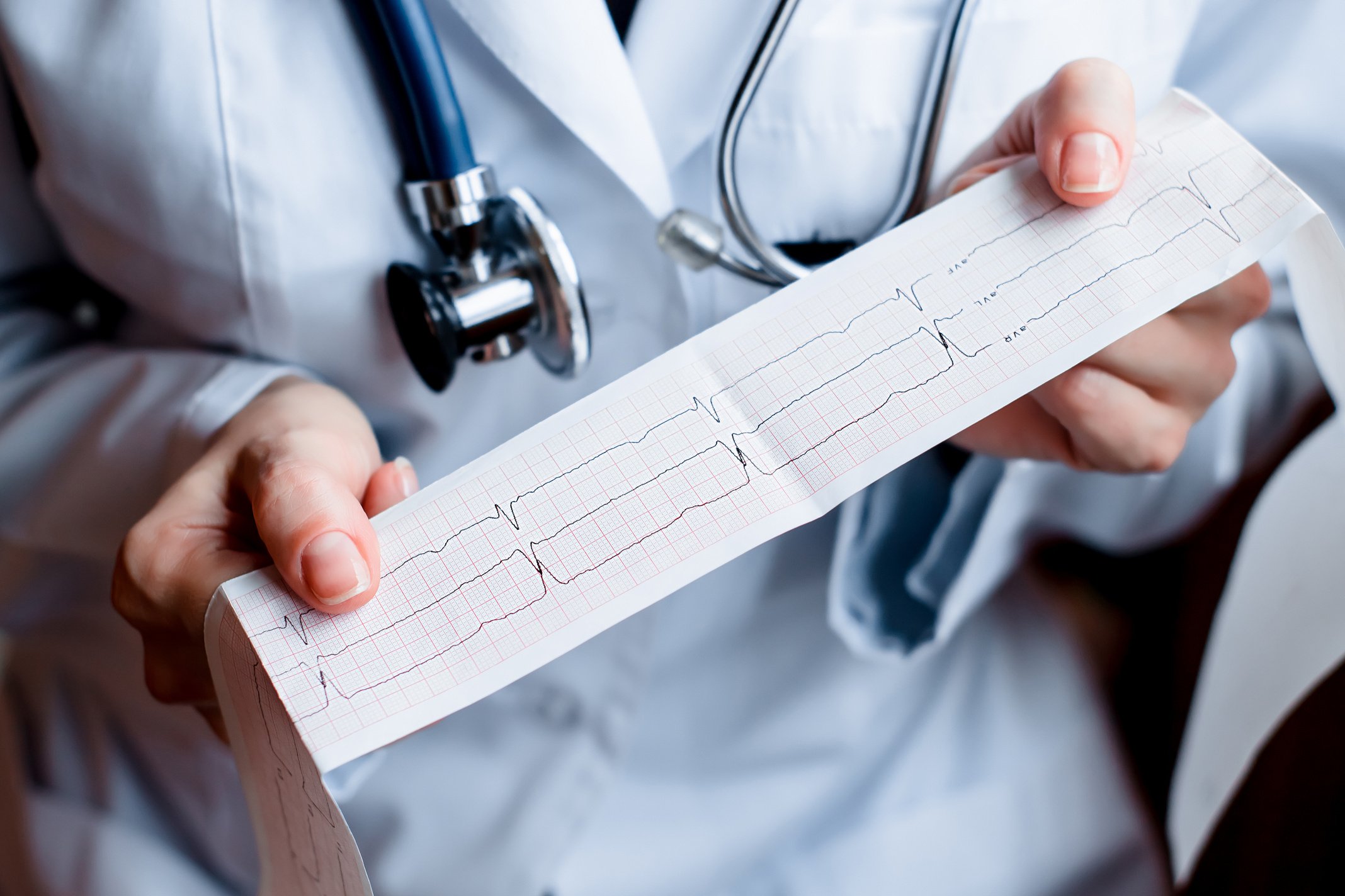Electrocardiogram. Medical health care.